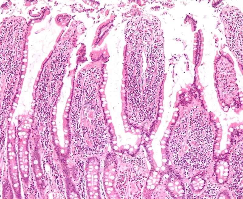 人類腸道的表面積相當於一間單身公寓。
