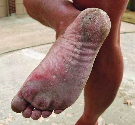 供您參考：在紐約市赤腳走路安全嗎？